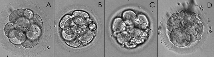 ¿En Qué Consiste La Clasificación Embrionaria? | IN VITRO Buenos Aires