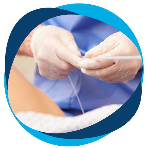 congelar óvulos fecundación artificial