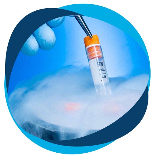 Criopreservación de embriones sobrantes fecundación in vitro