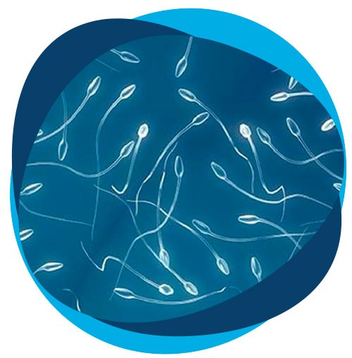 Obtención del semen para inseminación artificial