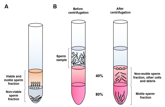 métodos de selección espermática
