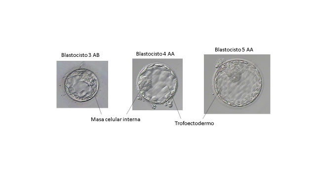 Clasificación Embrionaria In Vitro Buenos Aires