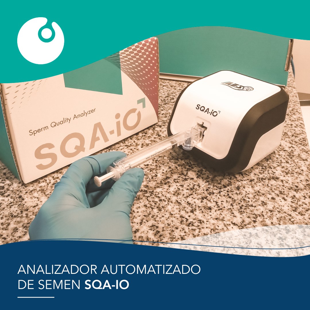 Spermogramma testi Qozon