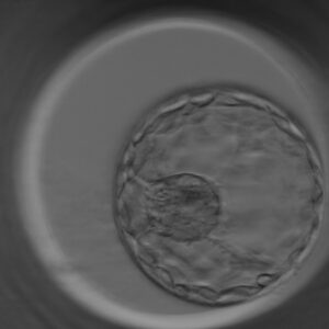 Blasto - In Vitro Buenos Aires