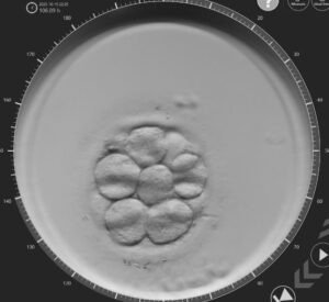 Embrión dia 3 - In Vitro Buenos Aires