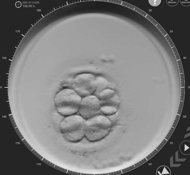 Embrión dia 3 - In Vitro Buenos Aires